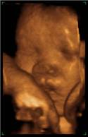 Felicia - a picture cut from 4D ultra sound video
